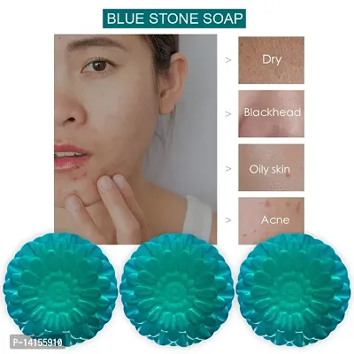 Get A Refreshing And Energizing Bath With Blue Stone Soap Pack Of 3-thumb0