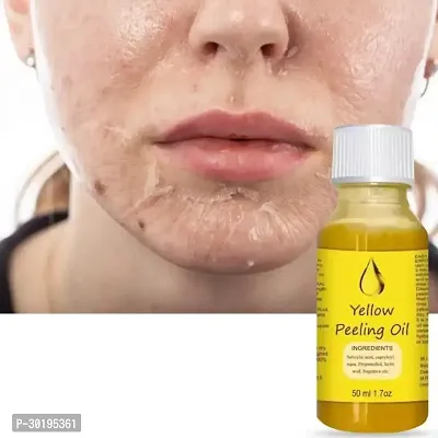 Whitening Yellow Peeling Oil Extra Strength for Body 50 Ml