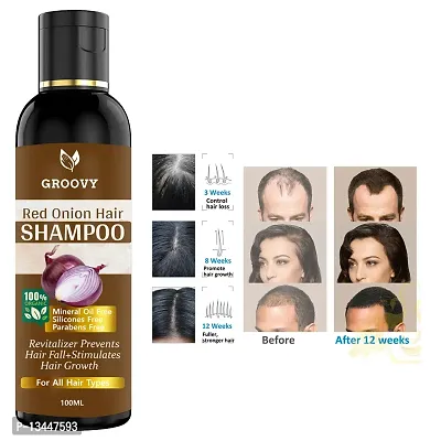 Onion Hair Shampoo With Black Seed Shampoo Extracts - Controls Hair Fall 100Ml Hair Shampoo 100 Ml)-thumb0