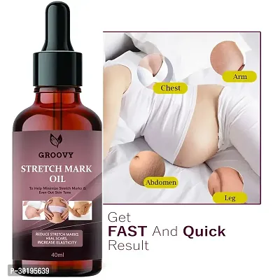 Bye Bye Stretch Marks Oil Pack of 1  40 Ml