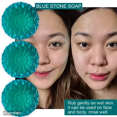 Say Hello To Healthy, Glowing Skin With Blue Stone Soap Pack Of 3-thumb0