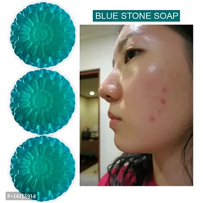 Blue Stone Soap: Cleanse And Hydrate Your Skin Pack Of 3-thumb0