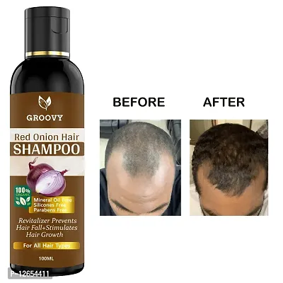 &nbsp;Onion Shampoo - Black Seed Onion Hair Shampoo  Hair Shampoo 100 Ml)