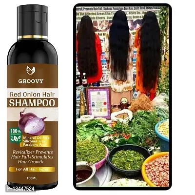 &nbsp;Red Onion Hair Shampoo&nbsp;Controls Hair Fall And Promotes Growth - Hair Oil 100Ml-thumb0