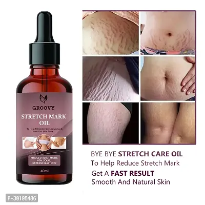 Ayurvedic Body Massage Bio Oil for Stretch Marks, Oil for Scar Removal, Aging   Wrinkled Skin  40 ml