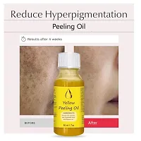 Yellow Peeling Oil Exfoliating Dark Skin for Body, the peeling solution 50 ml-thumb1