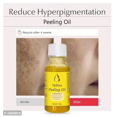 Yellow Peeling Oil Exfoliating Dark Skin for Body, the peeling solution 50 ml-thumb2