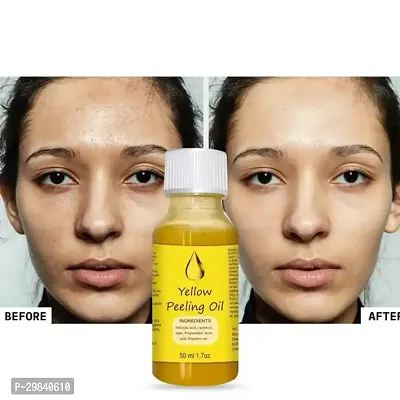 Yellow Peeling Oil Exfoliating Dark Skin for Body, the peeling solution 50 ml-thumb4