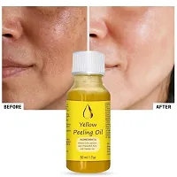 Yellow Peeling Oil Exfoliating Dark Skin for Body, the peeling solution 50 ml-thumb2