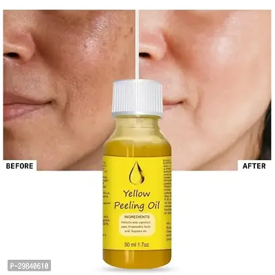 Yellow Peeling Oil Exfoliating Dark Skin for Body, the peeling solution 50 ml-thumb3