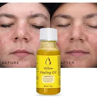 Whitening Yellow Peeling Oil,Skin for Body Dark Spot Face-thumb3