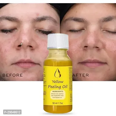 Whitening Yellow Peeling Oil,Skin for Body Dark Spot Face-thumb4