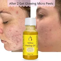 Whitening Yellow Peeling Oil,Skin for Body Dark Spot Face-thumb2