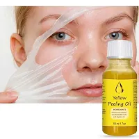 Peeling Oil for Yellow Dark Skin, Extra Strength, Exfoliating Peeling Solution-thumb1