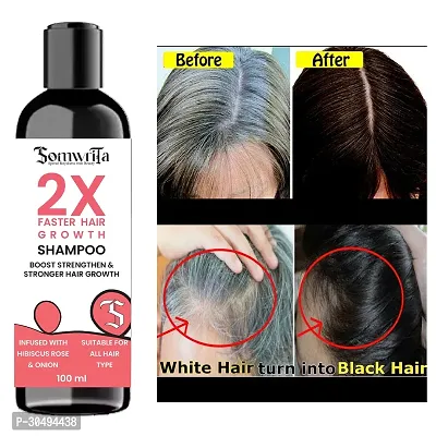 2X Faster Hair Growth With Hibiscus, Rose, And Onion For Strengthen and strong hair- 100ml-thumb5