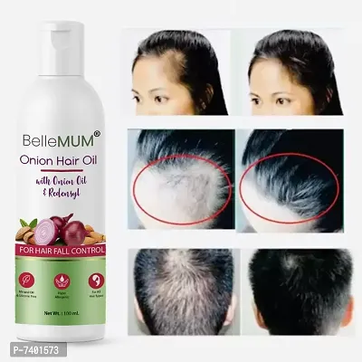 Bellemum Red Onion Hair Oil 100ml with 100% Results Garneted-thumb0