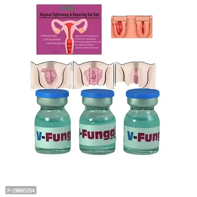 vaginal itching/ vaginal infection cream/ vaginal infection treatment/  vagina tightening/ vagina tightening treatment (5ml x 3 pcs )