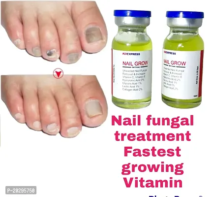 nail growth oil, nail care, nail softener, nail oil, nail repair, broken nail repair gel, nail serum, nail repair serum (10ml x 2 pcs )