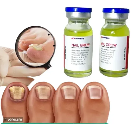 nail softener, nail oil, nail repair, broken nail repair gel, nail serum, nail repair serum, nail pedicure kit, nail repair gel, nail care kit, nail fungus treatment (10ml x 2 pcs )-thumb0
