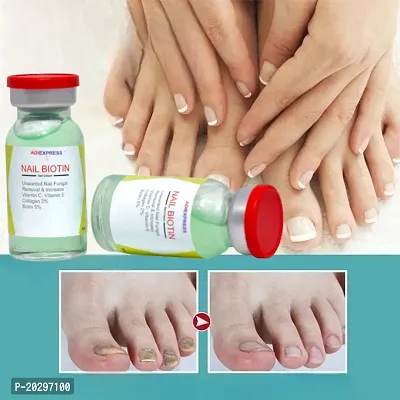 nail repair serum, nail pedicure kit, nail repair gel, nail care kit, nail fungus treatment, toenail corrector patch, nail care serum (10ml x 2 pcs )-thumb0