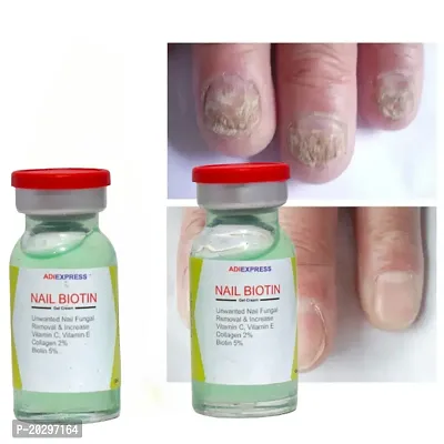 nail care oil, nail growth, toenail treatment, onychomycosis repair nail, nail strong growth oil, nail strengthener (10ml x 2 pcs )-thumb0