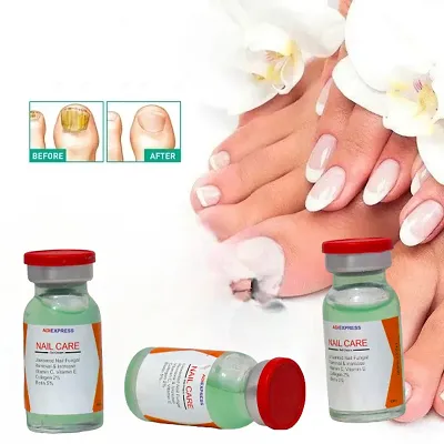 Skin Peeling At Fingertips: Ayurvedic Remedies To Treat It | OnlyMyHealth