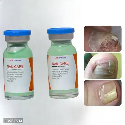 nail serum damaged, nail cutter, broken nail repair gel, nail repair serum, onychomycosis nail repair serum (10ml x 2 pcs )