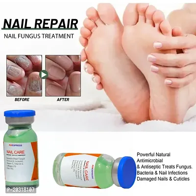 nail repair growth serum/ nail repair/nail growth/ repair nail fungus/ nail serum for nail growth/ nail care (10ml x 2 pcs )