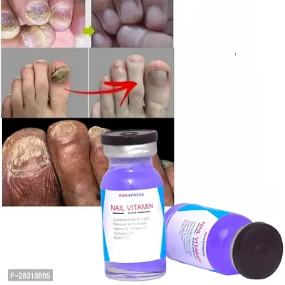 nail serum for nail growth/ nail care/ nail growth/ repair nail fungus/ nail repair serum/ repair/nail repair serum (10ml x 2  pcs )-thumb0