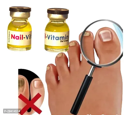 fungal toenail treatment, toe nail fungus, onychomycosis nail serum, onychomycosis nail repair growth serum (5ml x 2 pcs )