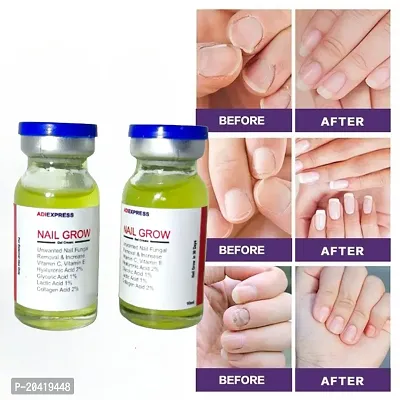 nail fungal infection drop, nail fungus treatment serum, toe nail fungus ointment, onychomycosis repair liquid, nail setter (10ml x 2 pcs )