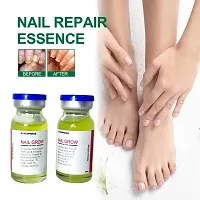 nail fungal infection drop, nail fungus treatment serum, toe nail fungus ointment, onychomycosis repair liquid, nail setter (10ml x 2 pcs )-thumb2