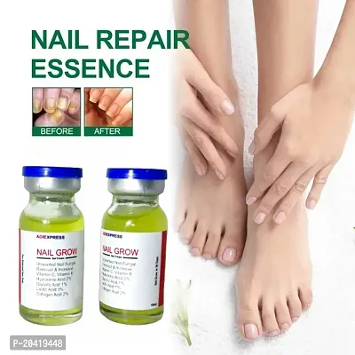 nail fungal infection drop, nail fungus treatment serum, toe nail fungus ointment, onychomycosis repair liquid, nail setter (10ml x 2 pcs )-thumb3