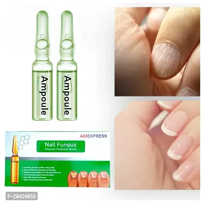 cuticle remover cream nails, foot nail repair serum, fungal nail infection treatment, nail repair serum treatment(20ml )