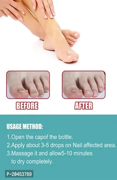 Nail repair treatment, Nail repair cream, Onychomycosis repair Cuticle oil nail growth, Nail repair oil, Nail strong oil (2ml x 7 pcs )-thumb2