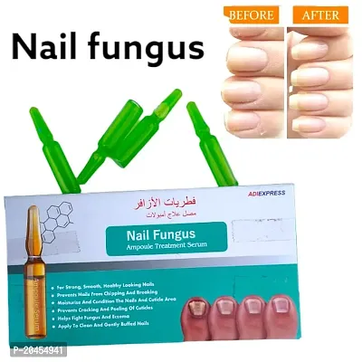 Nail growth oil, Nail gel, Gel nail polish kit, Nail strong growth oil, Nail strong oil, Nail strong, Nail cuticle oil, nail polish set (5ml x 4 pcs )