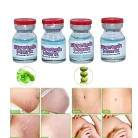 scar cream, scar removal cream for face, scar removal cream for body acne scar removal acne scars removal serum (5ml x 4 pcs )-thumb1