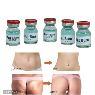 fat loss oil/ fat burning oil/ fat burning oil for women/ weight loss oil/ weight loss oil for women/ weight loss cream (5ml x 3 pcs )-thumb4