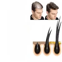 hair oil for men, hair growth oil for men, head hair growth oil for men, fast head hair growth oil for men, hair care oil (4ml 3pcs)-thumb1