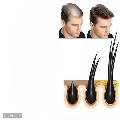hair oil for men, hair growth oil for men, head hair growth oil for men, fast head hair growth oil for men, hair care oil (4ml 3pcs)-thumb2
