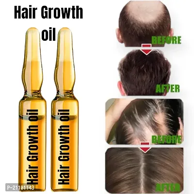 onion oil, onion oil and shampoo, onion oil combo, onion hair Growth Hair Oil , ganjapan oil,ganjapan door kare , bal badhane wala tel, bal badhane tel,(10ml 2pcs)