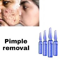 pimple cream, pimple cream for men, pimple cream for women, pimple remover cream for women, pimple dark spot remover cream for women, pimple remover cream for women,(5ml 4pcs)-thumb3