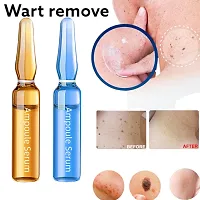 wart remover ointment cream, wart remover, wart removal serum, wart, skin tags, moles remover serum, wart removal cream (10ml 2pcs)-thumb2