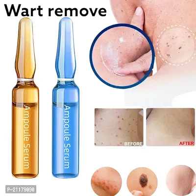 wart remover ointment cream, wart remover, wart removal serum, wart, skin tags, moles remover serum, wart removal cream (10ml 2pcs)-thumb3