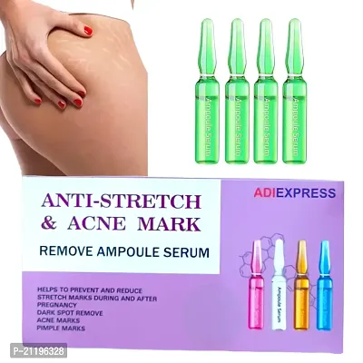 stretch mark cream for pregnancy, stretch mark removal cream, stretch marks oil for pregnancy, stretch mark cream, scar cream (5ml 4pcs)