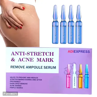 stretch mark cream, scar cream, scar removal cream for face, scar removal cream for body, acne scar removal (6ml 4pcs)