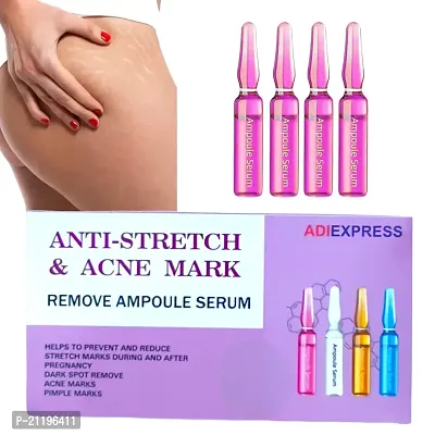 acne scar removal, acne scars removal serum, acne scars removal cream, acne scars, scar gel,stretch marks oil for pregnancy, stretch mark cream (5ml 4pcs)