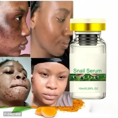 Dark Spot Remover For Face Freckles Melasma Sun Age Spots