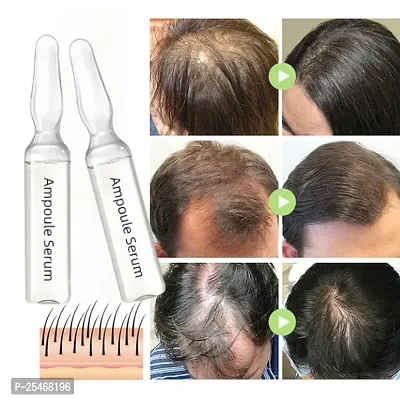 Hair Fast Growth Oil Effective Baldness Repair Hereditary Hair Loss(2ml10pcs)-thumb0