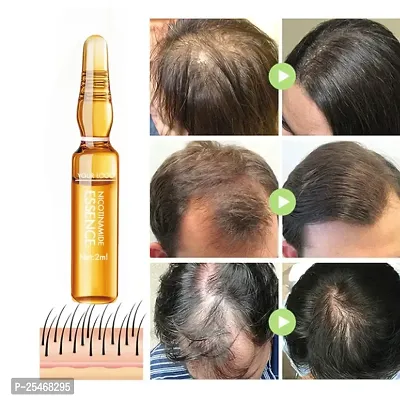 Hair Loss Postpartum Hair Loss Seborrheic Hair Loss Repair Of Hairline